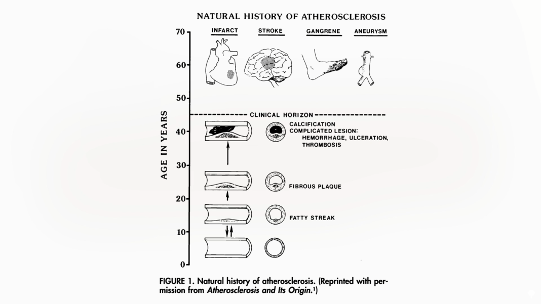 How to Beat Heart Disease Before It Starts