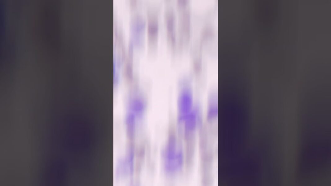 As-tu déjà vu un cancer au microscope ?!