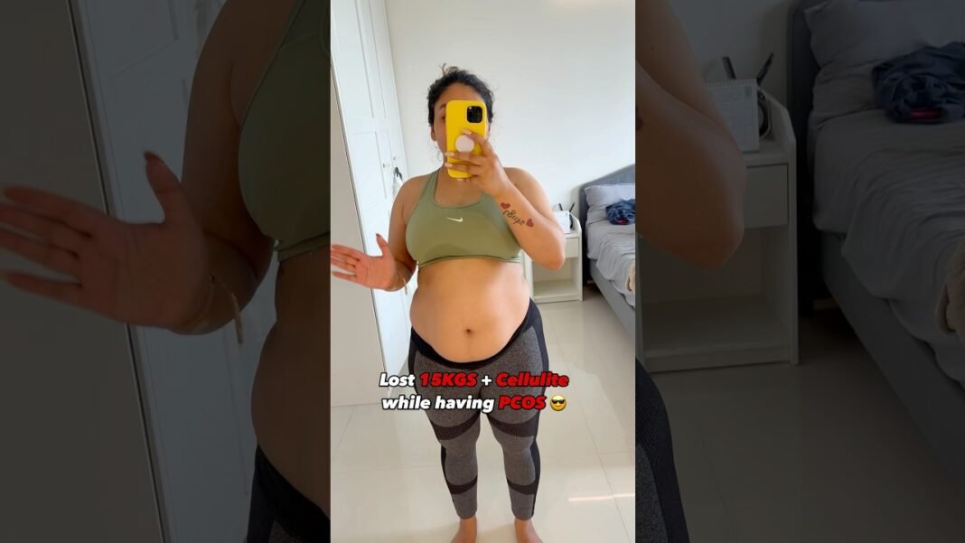 Lost 15kgs weight and cellulite despite having PCOS 🧿✨ #pcos #weightloss #weightlossjourney #shorts