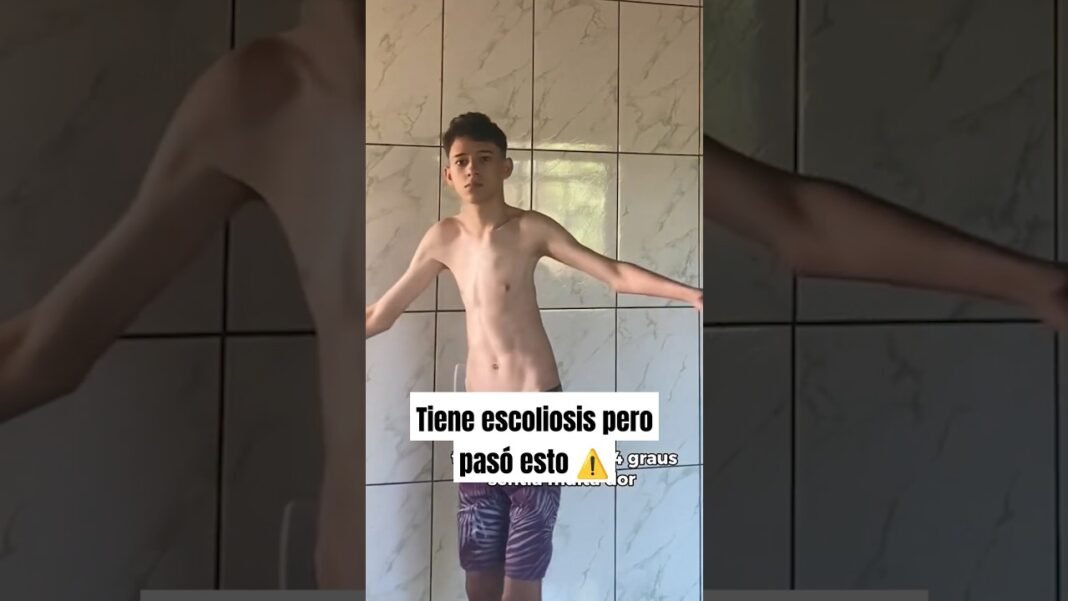 TenÃa escoliosis pero hizo esto #gym #escoliosis #fitness #bodybuilding