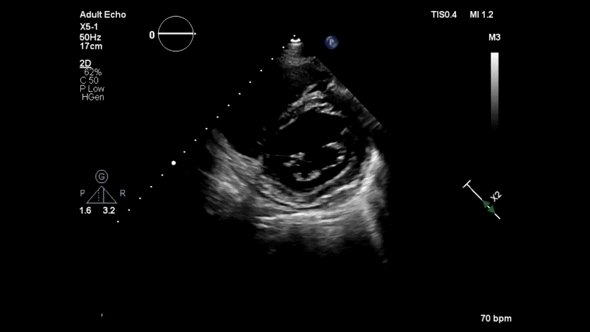 An Echo quiz | Dr.S.Venkatesan MD