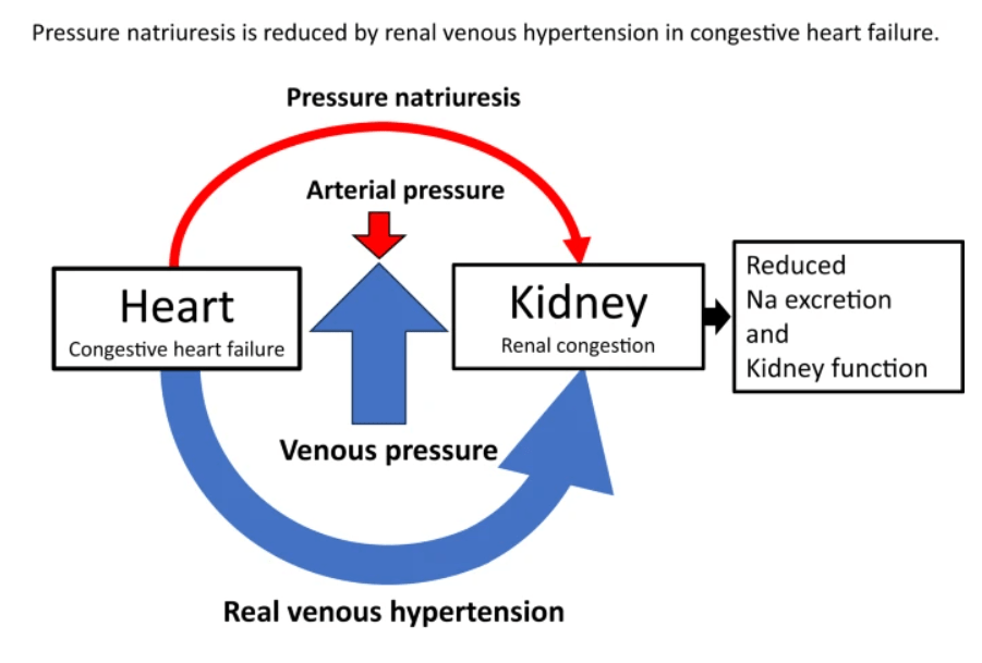 Cardio renal syndrome : Can’t Ignore ,Right ventricle’s secret agenda