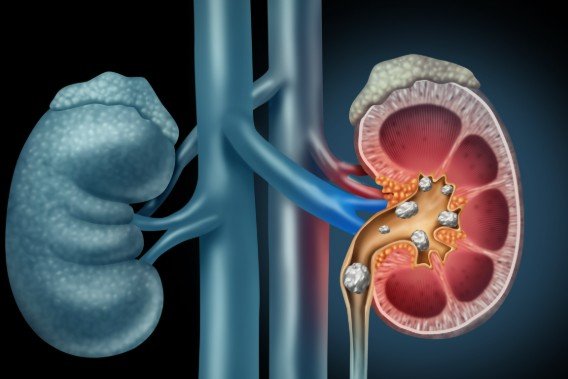 MCAS and Another Diagnosis! | AllergicChild