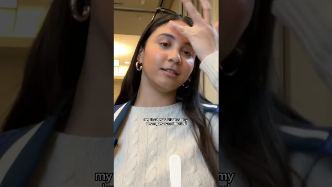 How I lost 30 pounds without dieting