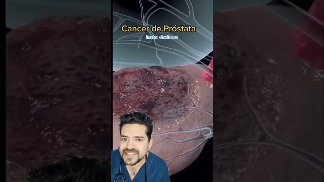 Así es el cáncer de próstata #drarmenta #drarmenta #salud #suscribete #drvicarmenta