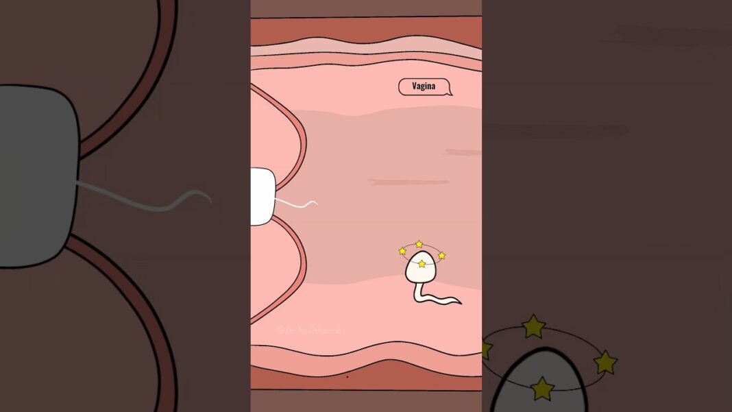 How Does the Copper IUD Actually Work? #shorts