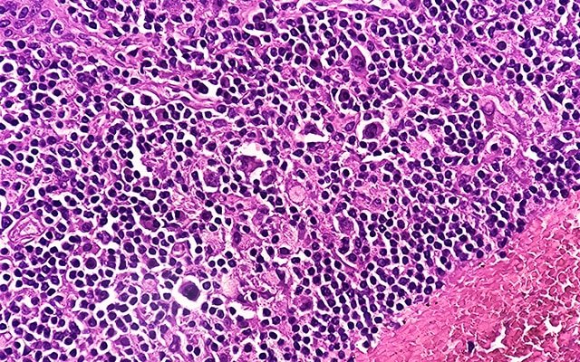 FDA Approvals in Oncology: January-March 2026 | Blog