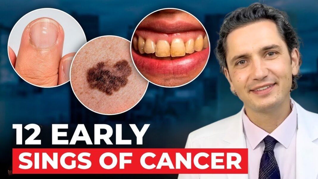 12 Early Signs of Cancer People Ignore (Until Itās Too Late)