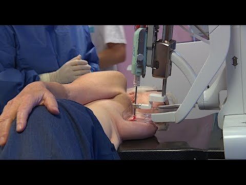 Cancer du sein : une biopsie pour confirmer le diagnostic – Allô Docteurs