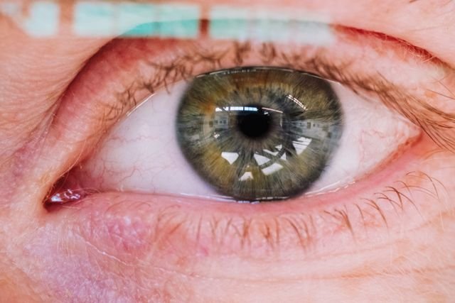 Best Vivity Lens Cataract Surgeon In Estero: Top IOL Specialist Guide