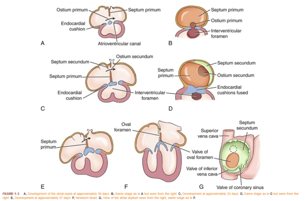 Embryology of ASD : The cheat sheet